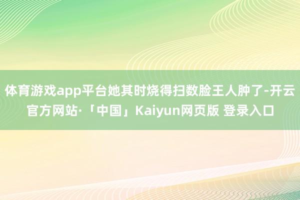 体育游戏app平台她其时烧得扫数脸王人肿了-开云官方网站·「中国」Kaiyun网页版 登录入口
